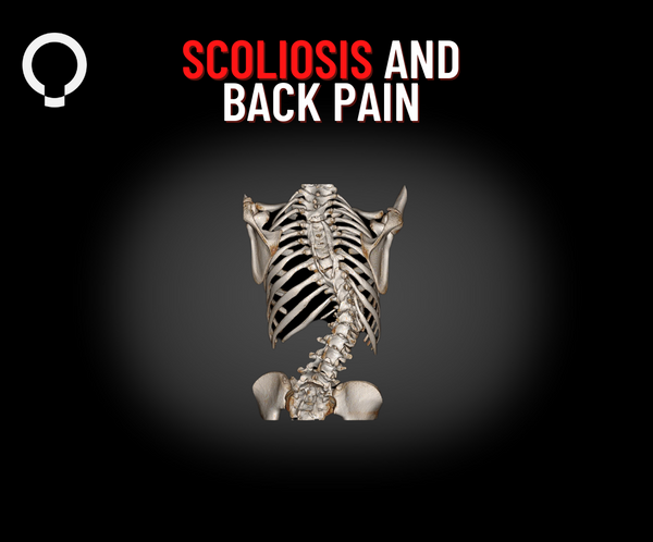 CASE STUDY: Addressing Scoliosis and Back Pain with Ashley Kramer