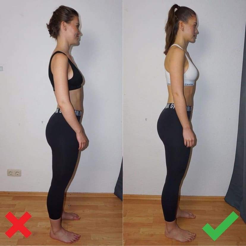 Correct Poor Posture – Functional Patterns
