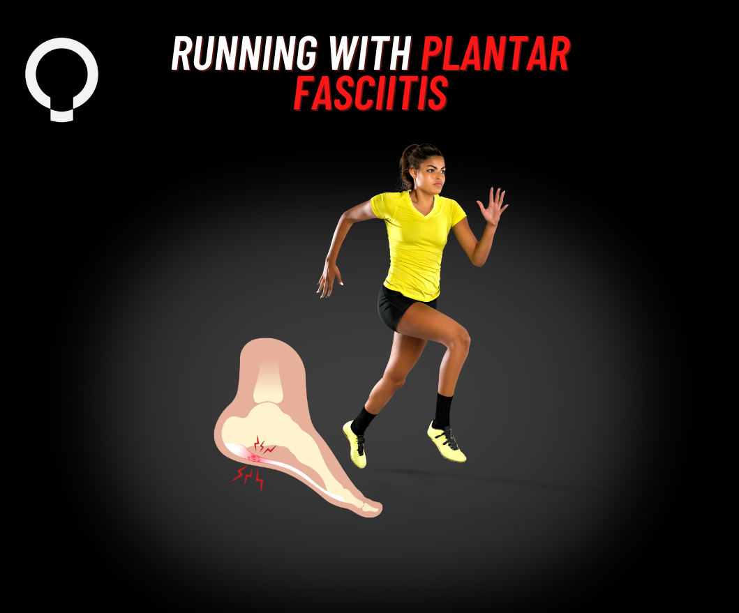 Running with Plantar Fasciitis – Functional Patterns