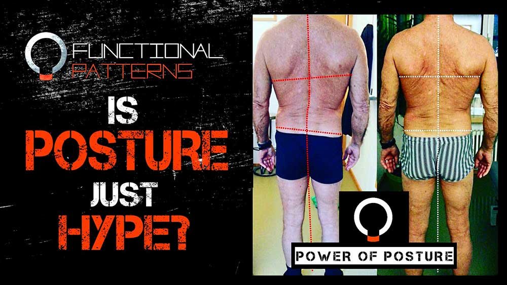 Posture Training - Is it all just hype?