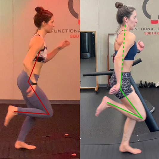 IMPROVED GAIT WITH EX-YOGA INSTRUCTOR