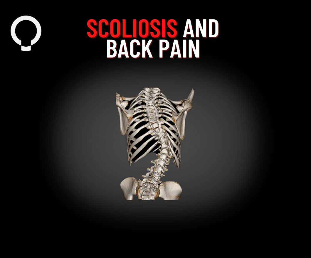 CASE STUDY:  Addressing Scoliosis and Back Pain with Ashley Kramer