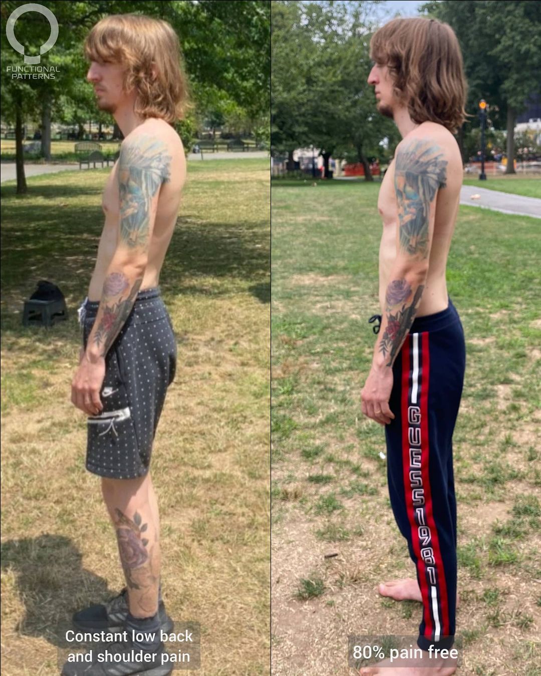 5 Years Of Back Problems 80% Reduced In 2 Sessions – Functional Patterns