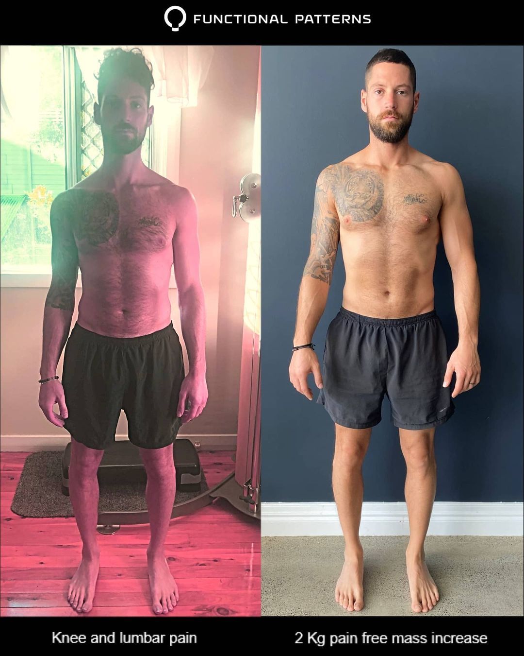 Pain Free Mass Gains While Eliminating Pain