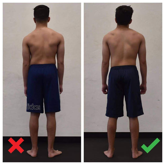 Scoliosis Structure Gains from Certified HBS practitioner by Functional Patterns