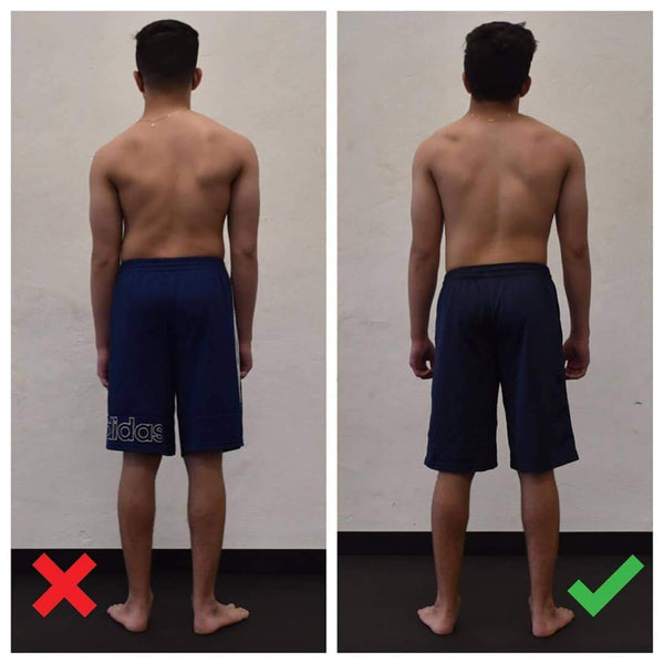 Scoliosis Structure Gains from Certified HBS practitioner by Functional Patterns