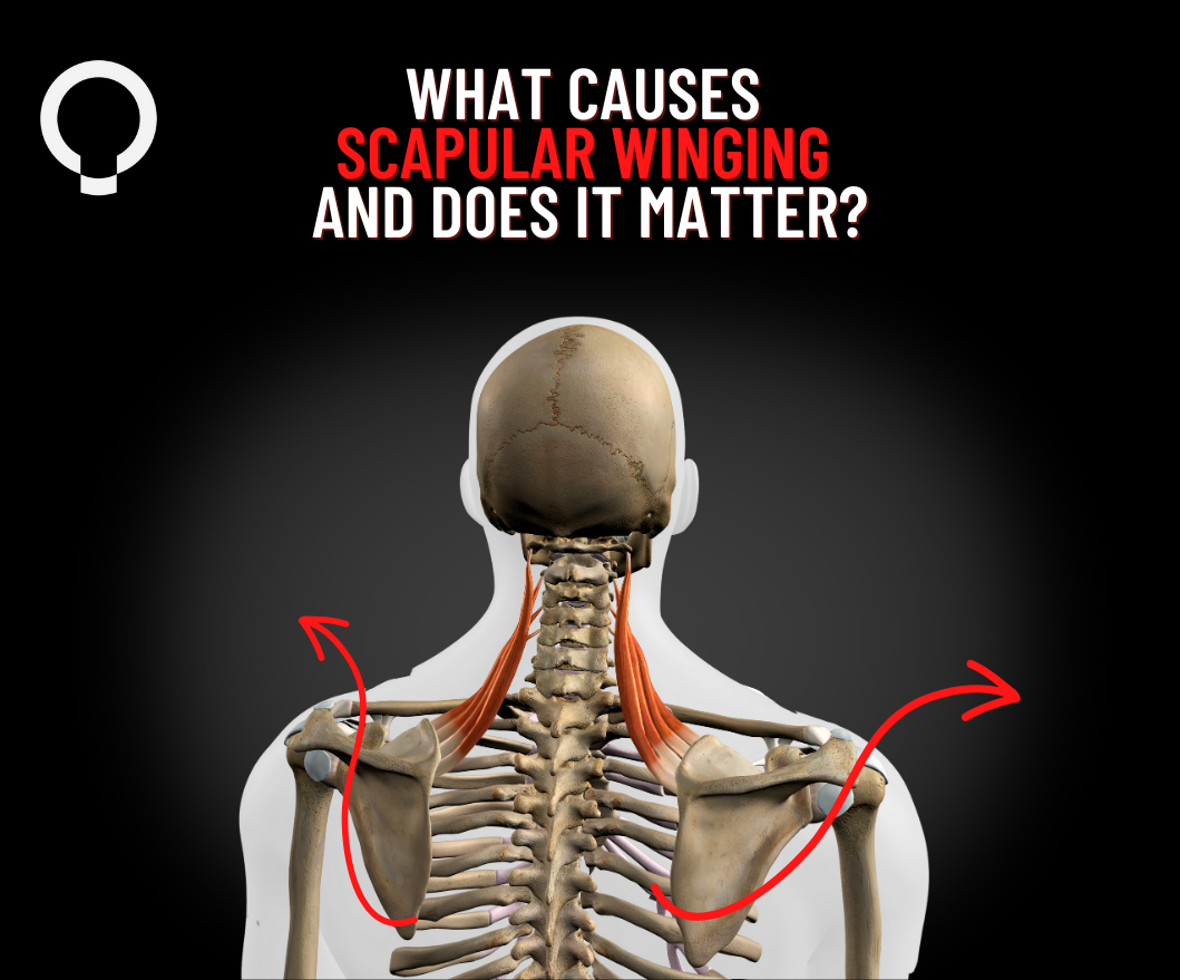 What Causes Scapular Winging and Does It Matter?