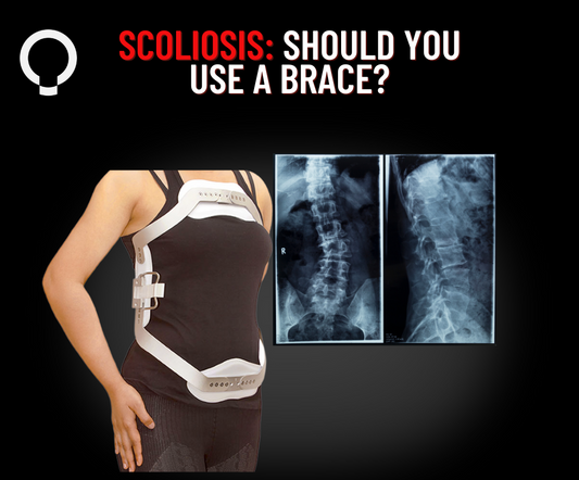 Scoliosis, Should you use a brace?