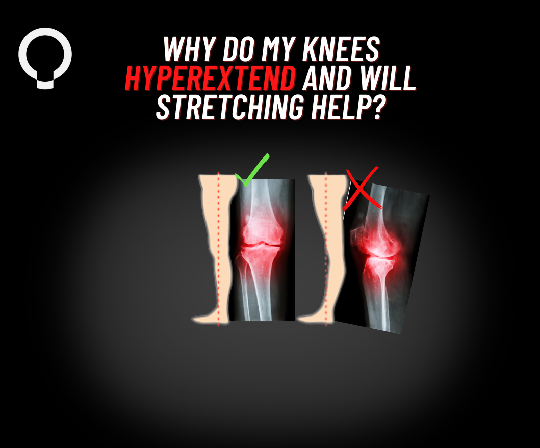 Why do my knees hyperextend and will stretching help?