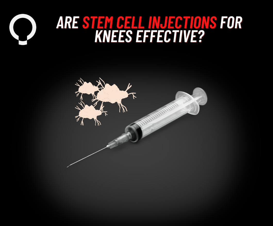 Stem Cell Injections for Knees An Examination of Its Effectiveness an
