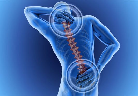 Back Pain Prompted by a Flat Spine