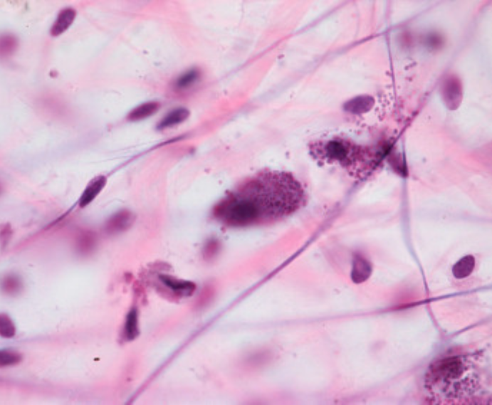 Viscoelasticity and 4th Phase Water