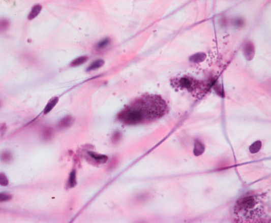 Viscoelasticity and 4th Phase Water