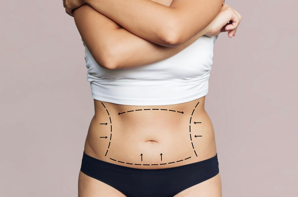 In Search of a Core Transformation: Functional Patterns vs. Tummy Tucks