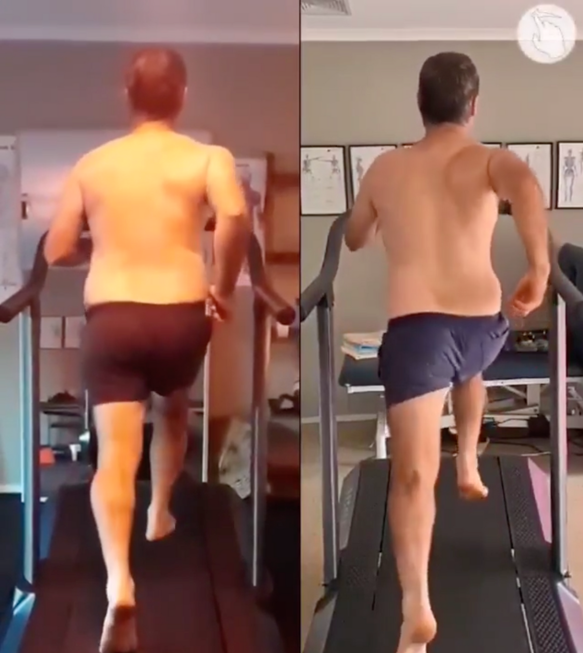 Weightloss And Sciatic Pain Free Movement Gains At 48