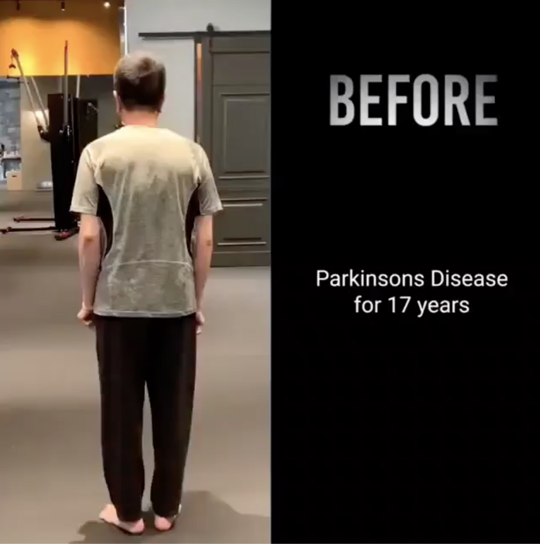 Reversing Degeneration From Parkinson's