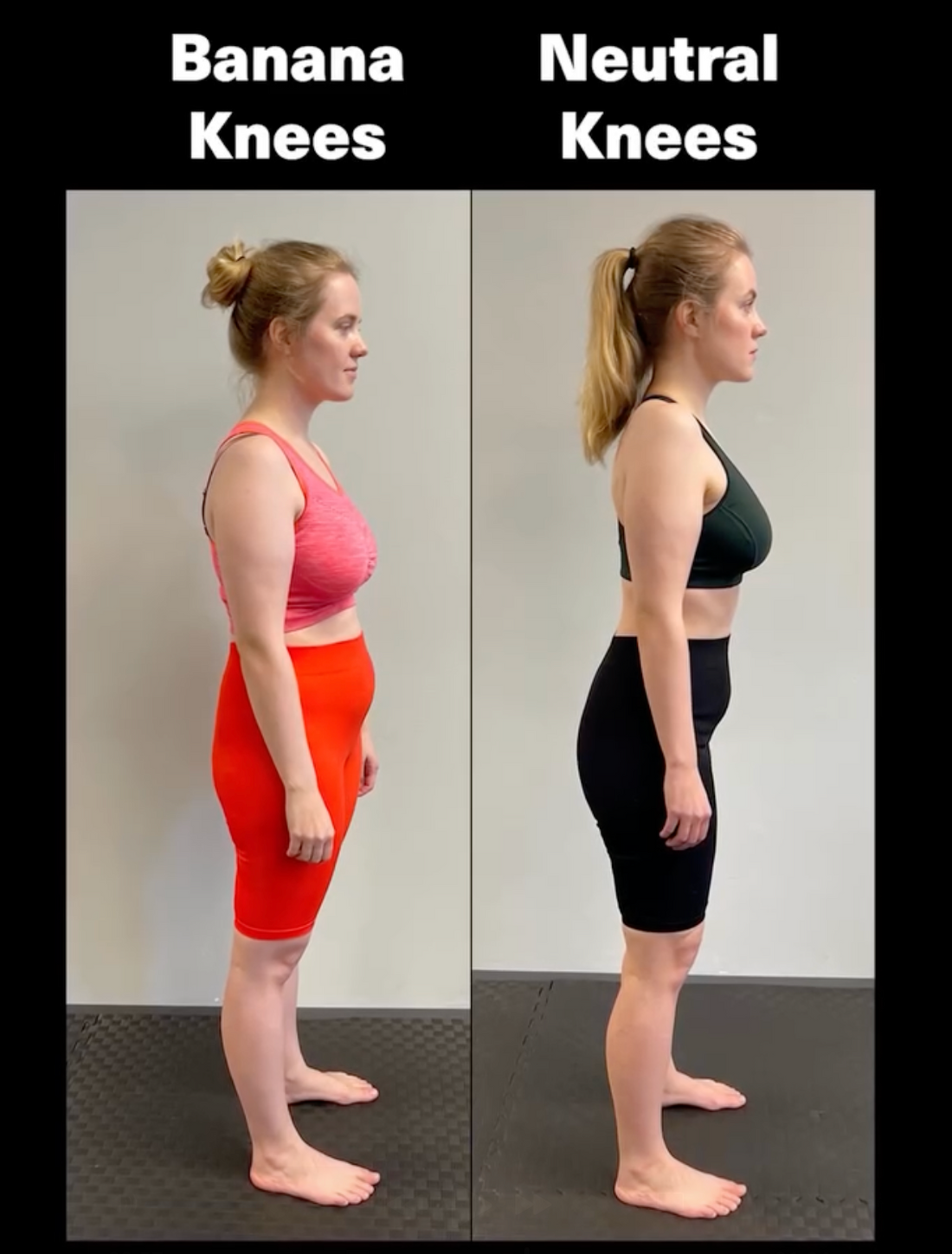 One Woman's Migraine and Posture Correction