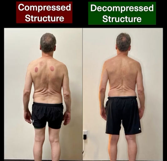 From Chronic Pain to Full-Body Renewal: Darrell’s Comeback with FP