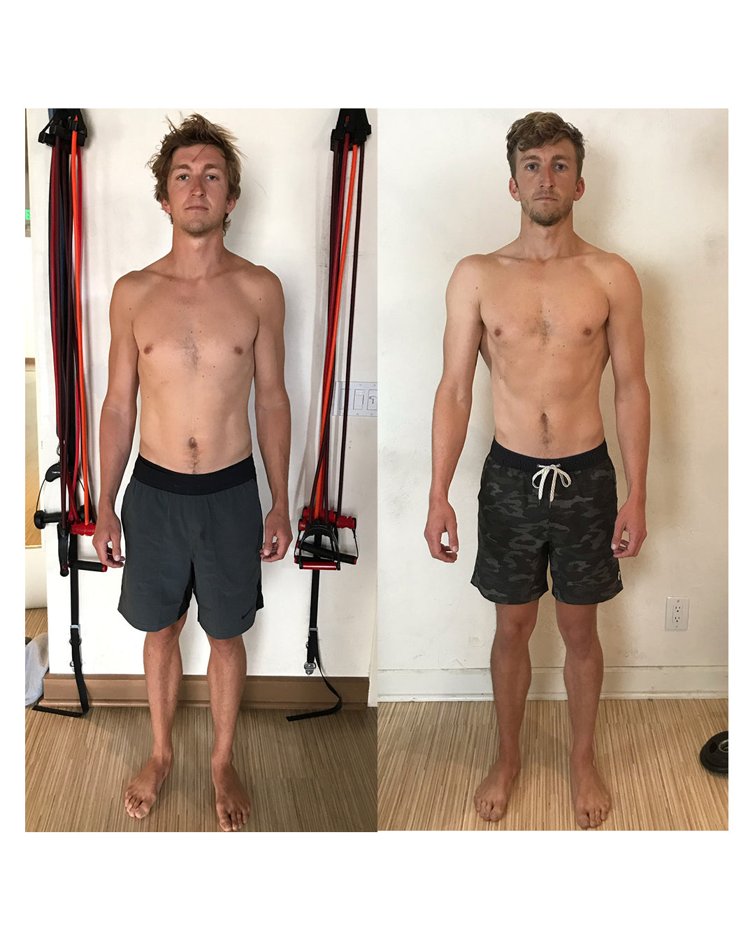 From chronic shoulder pain to zero pain.