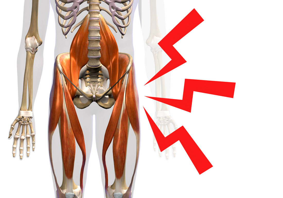 Addressing General Hip Flexor Pain in Everyday Life – Functional Patterns