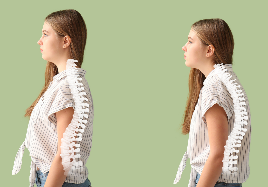 Decoding Kyphosis and Lordosis: Insights into Spinal Curvature Disorders