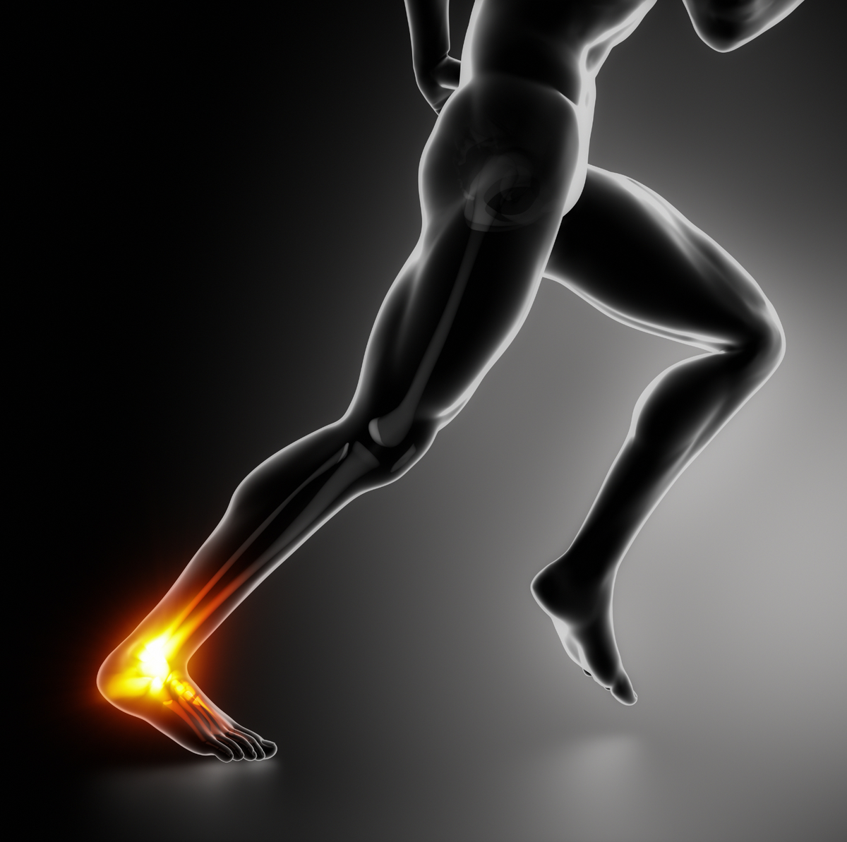 Graphic of a runner's Achilles tendon glowing orange to show injury