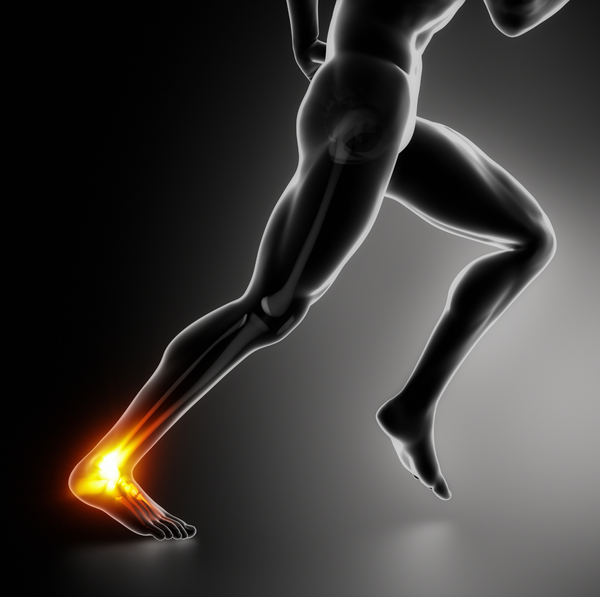 Graphic of a runner's Achilles tendon glowing orange to show injury