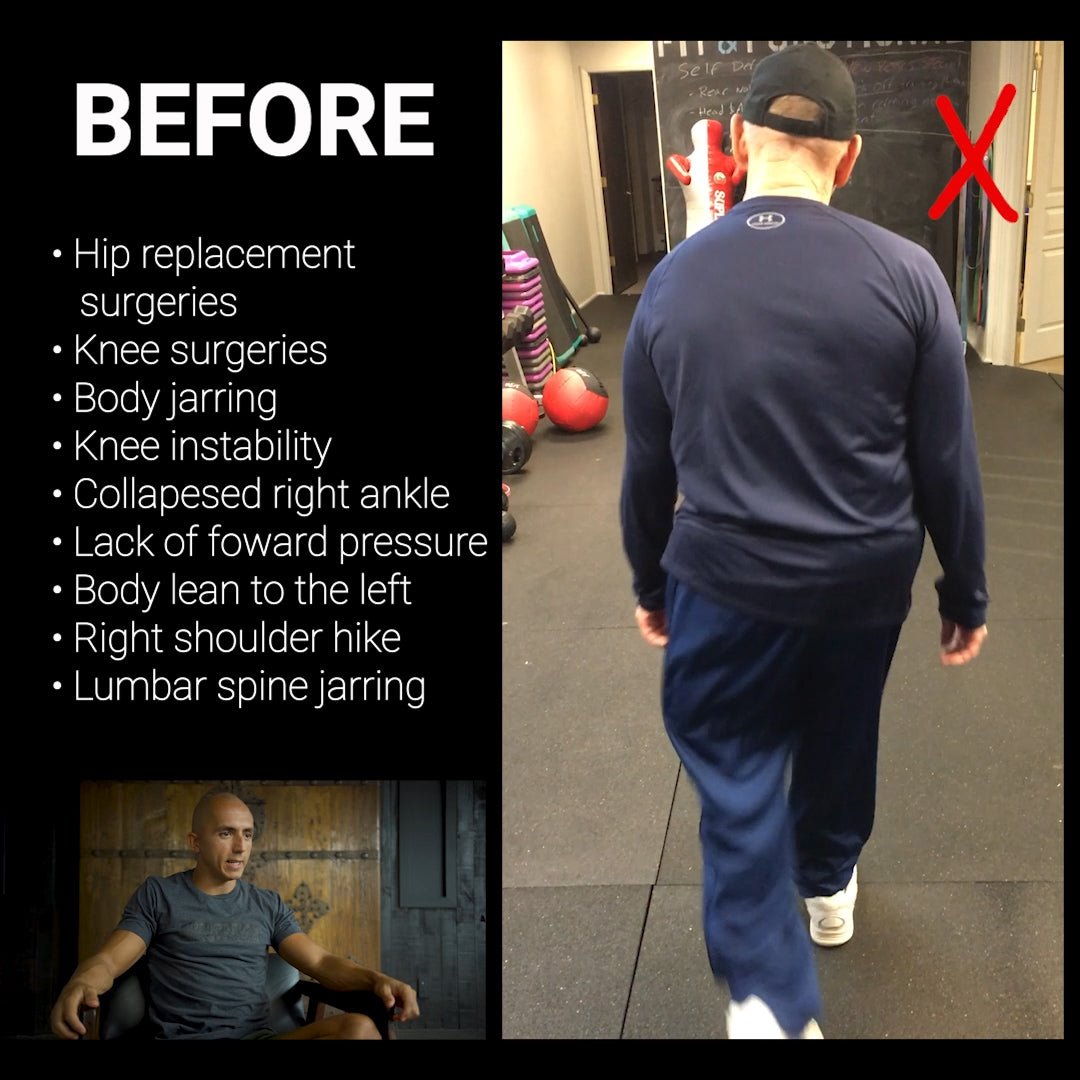 Hip replacement and knee surgery gains!