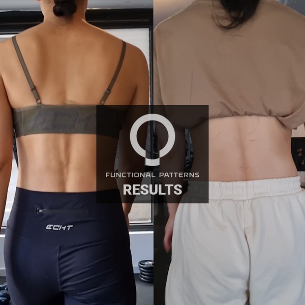 Spine protrusion improvements