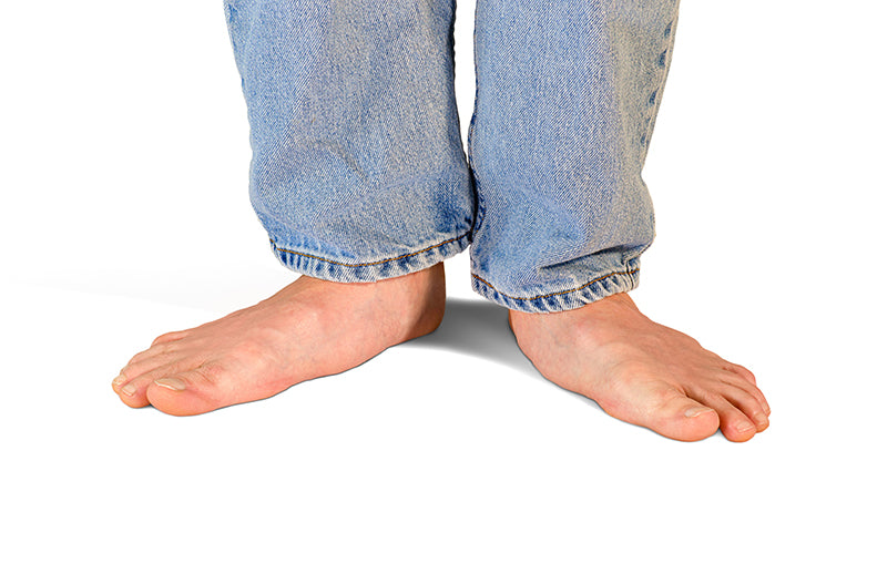 Flat feet vs Normal feet... What Causes Duck Feet Posture?