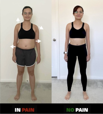 Jennifer's Scoliosis Improved