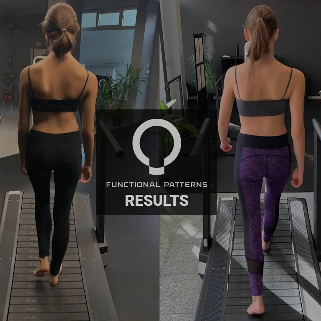 Scoliosis Optimization