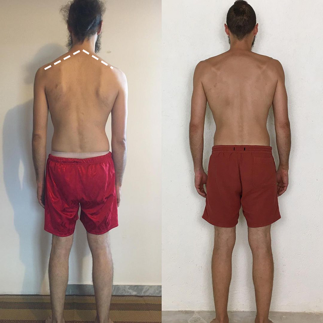 The Power of Posture – Functional Patterns