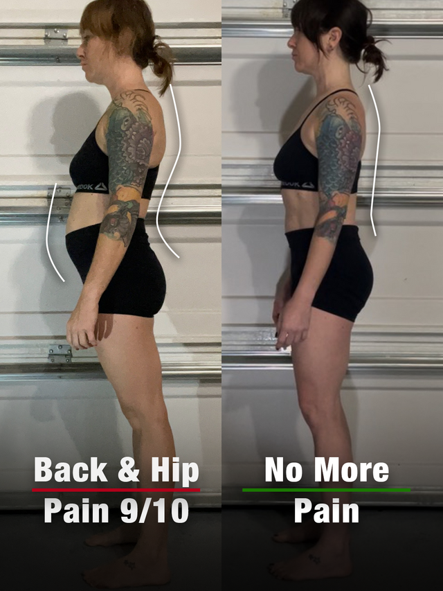 Kayla, 36 — Hair Stylist. Reduced pain from 9/10 to near zero; now works full days pain-free.